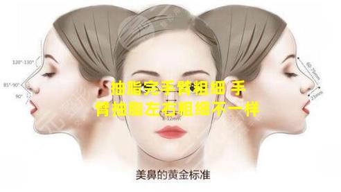 抽脂完手臂粗细 手臂抽脂左右粗细不一样